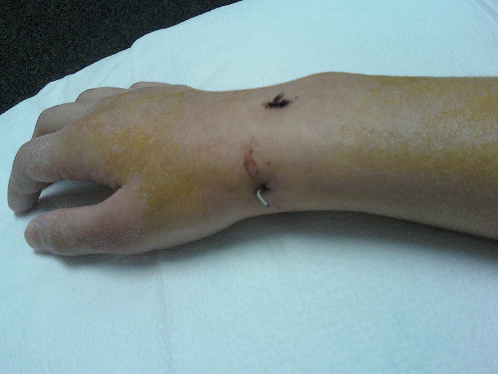 First day in the summer park