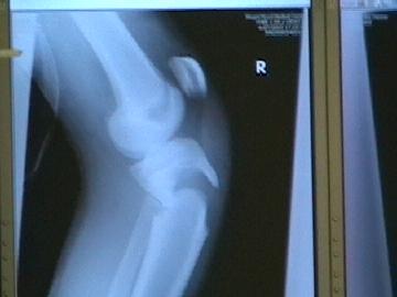 first day of camp, 15 minutes of arriving and 5 jumps on the super tramp...