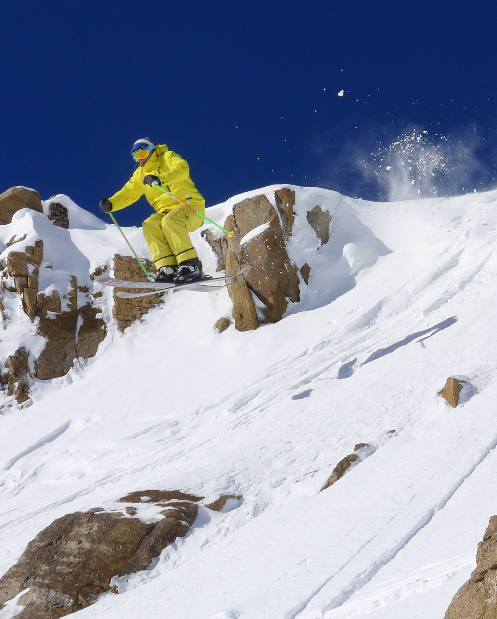 First huck 3 months after major surgery