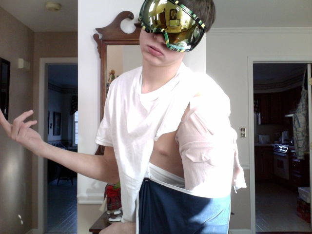 Fractured humerous...