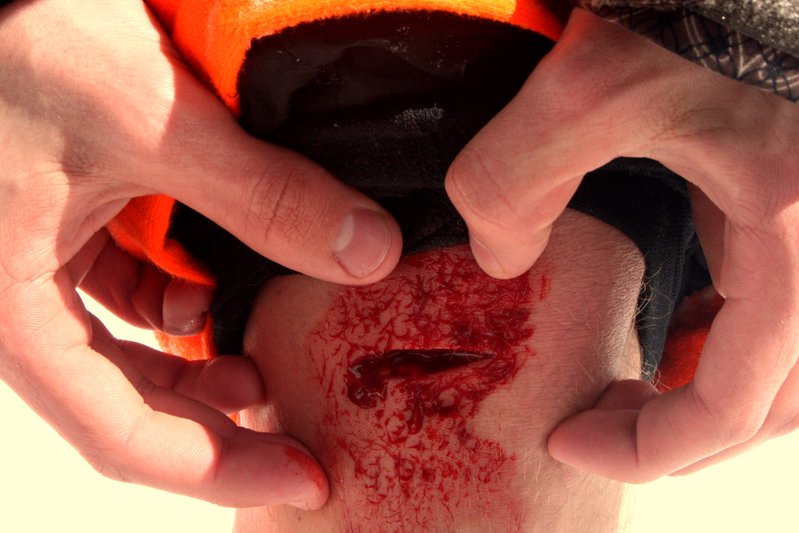 Got in a fight wit my ski