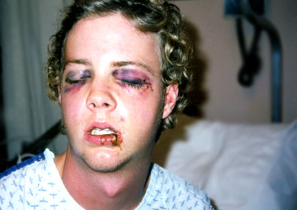 HE LOOKS LIEK ORFEO!