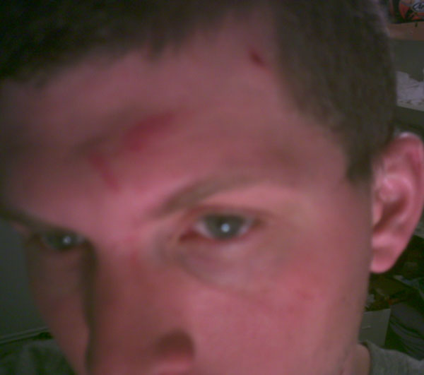 Head injuries from 540 attempt