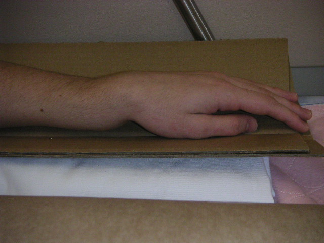 Horribly broken wrist...