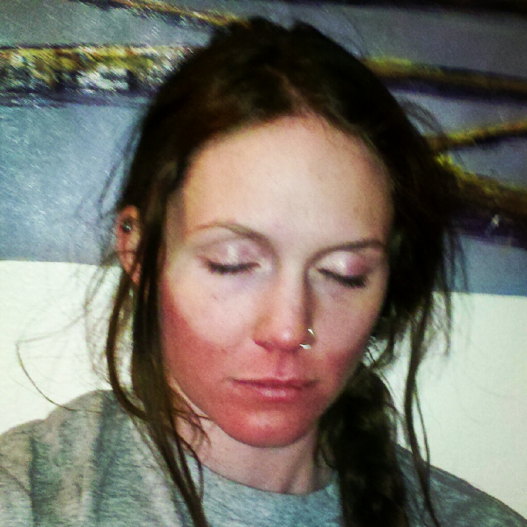 if you forget your sunscreen you're gonna have a bad time