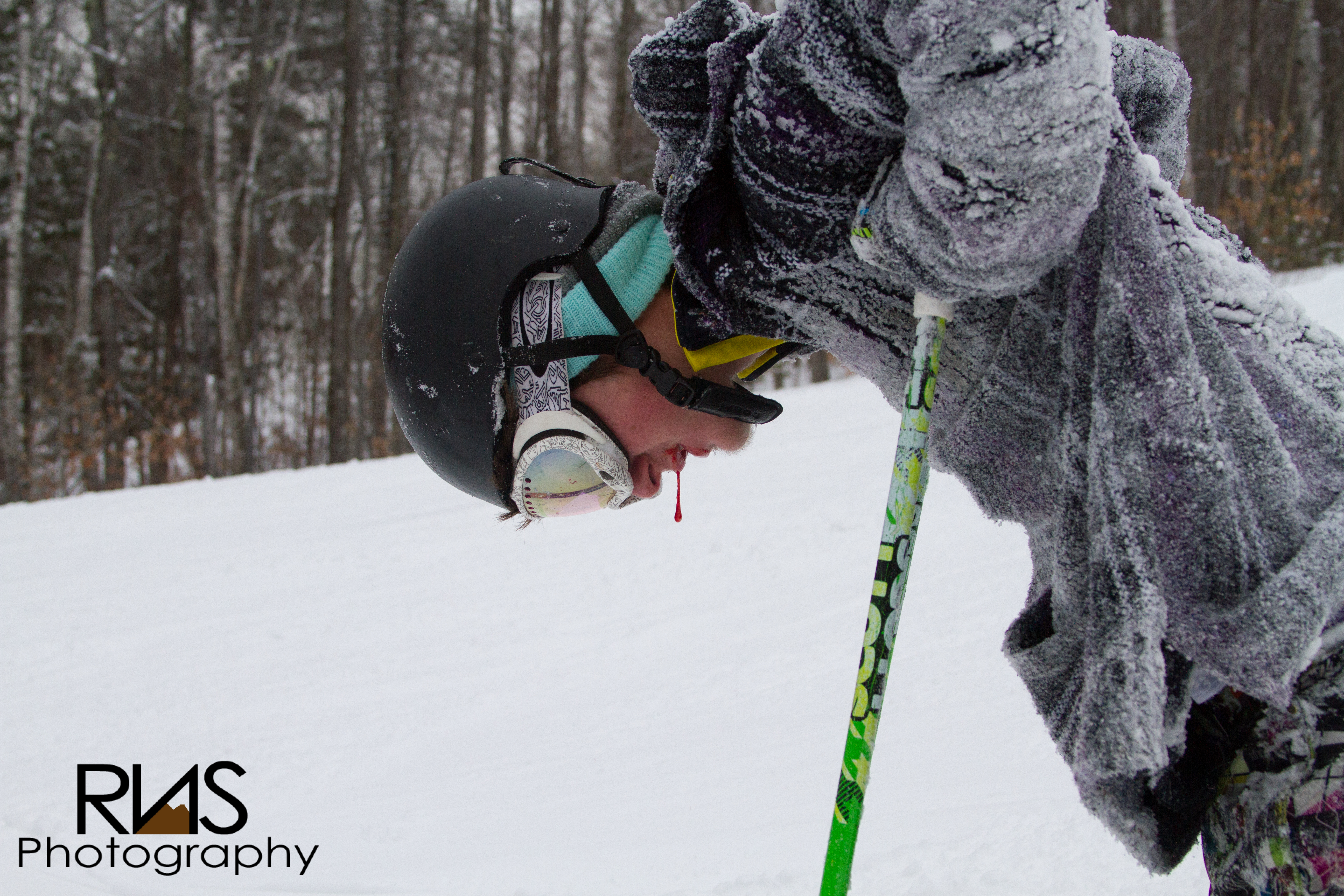 Injury from Rodeo off Rail