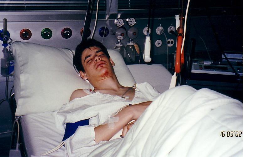 Just after operation, still unconcious