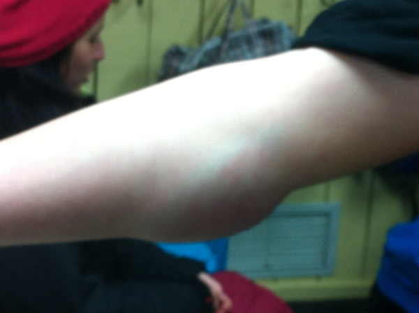 landed on my arm a couple time