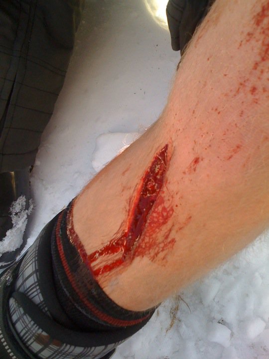 Leg gash