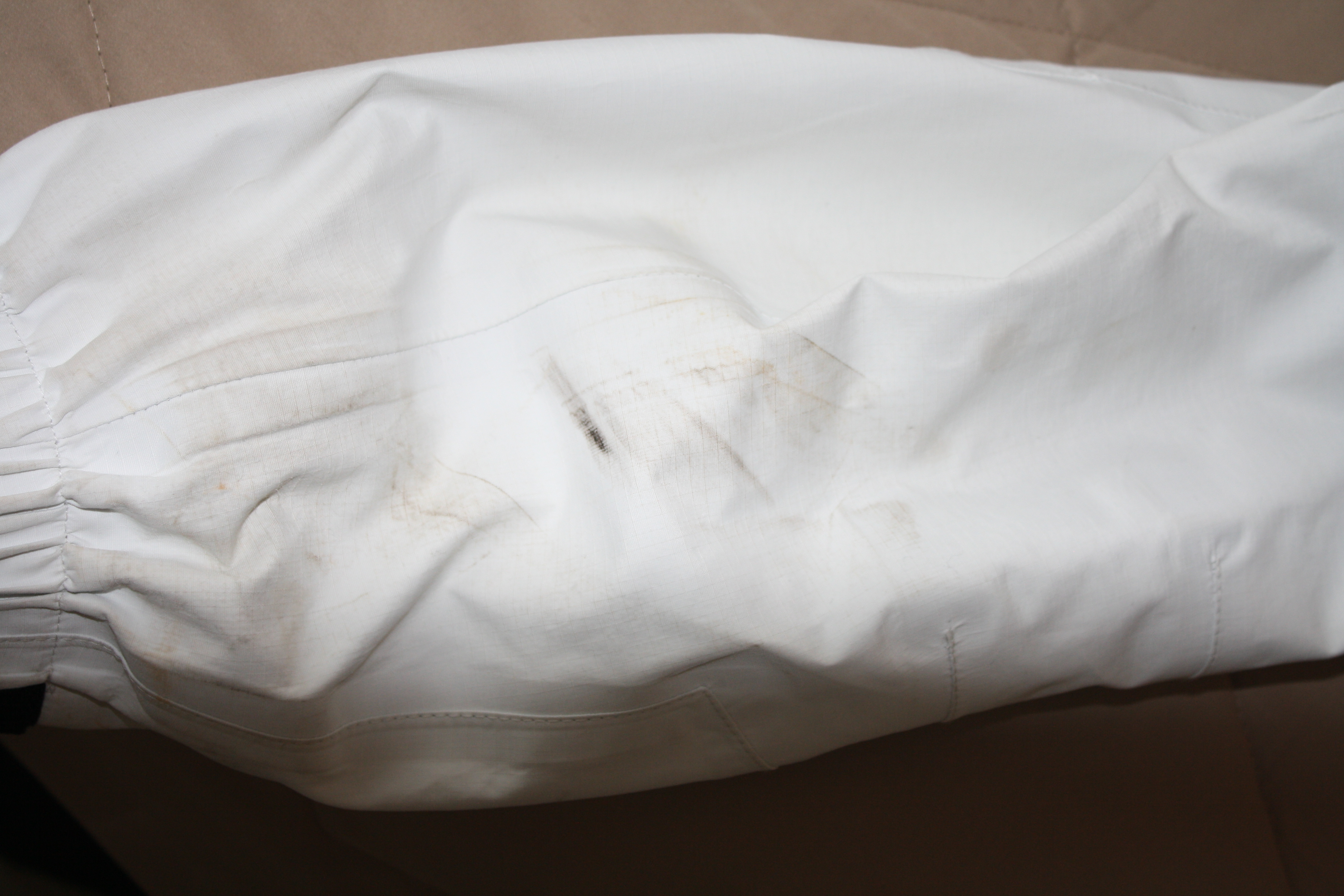 less than inch mark, back of right arm