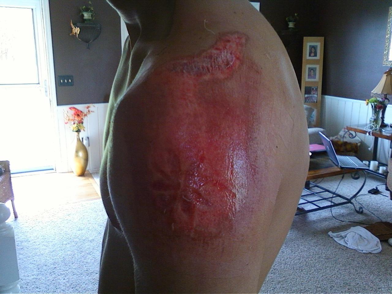 Longboard crash