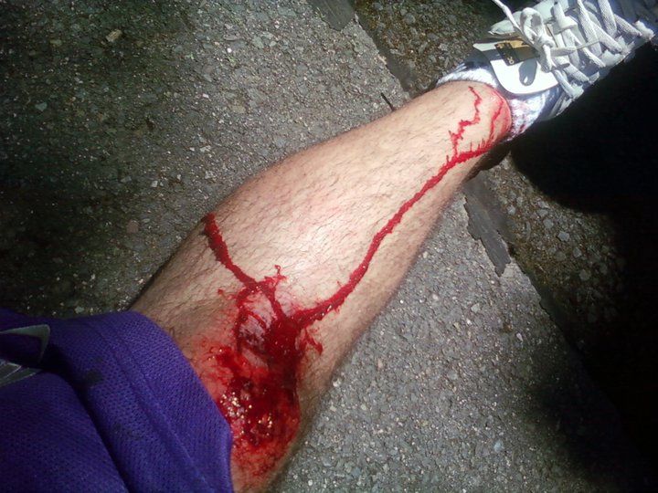 Longboarding crash