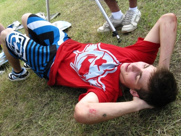 Look at my elbowssssss