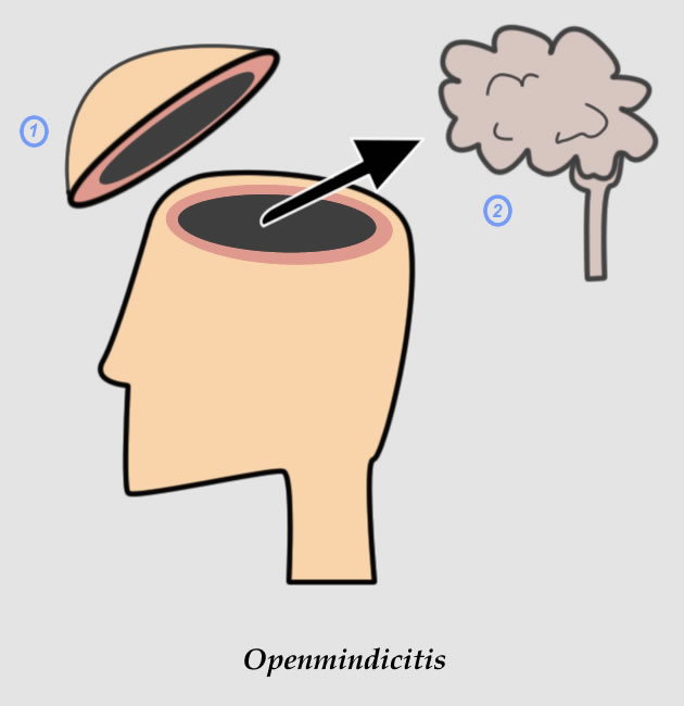 Many people today suffer from this scourge...