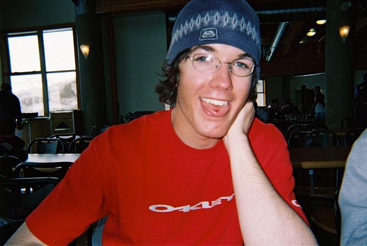 me after I bit a hole in my tounge