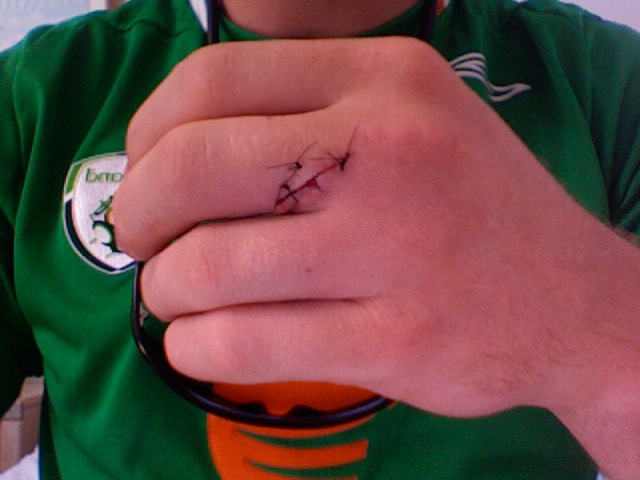 More fun with spearguns