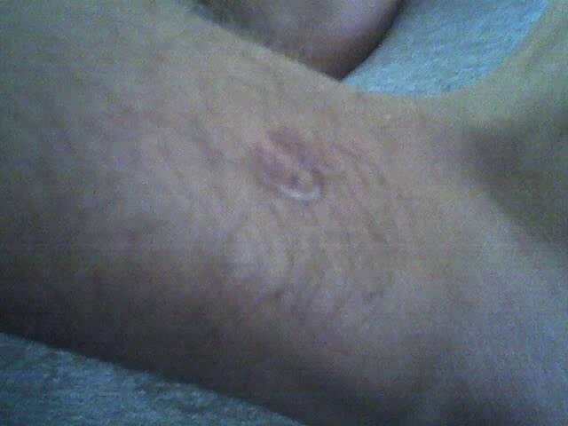 Motha fucka burned me