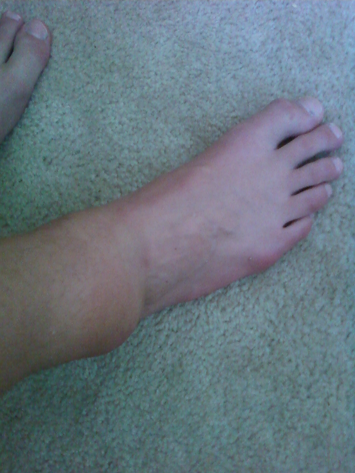 My ankle