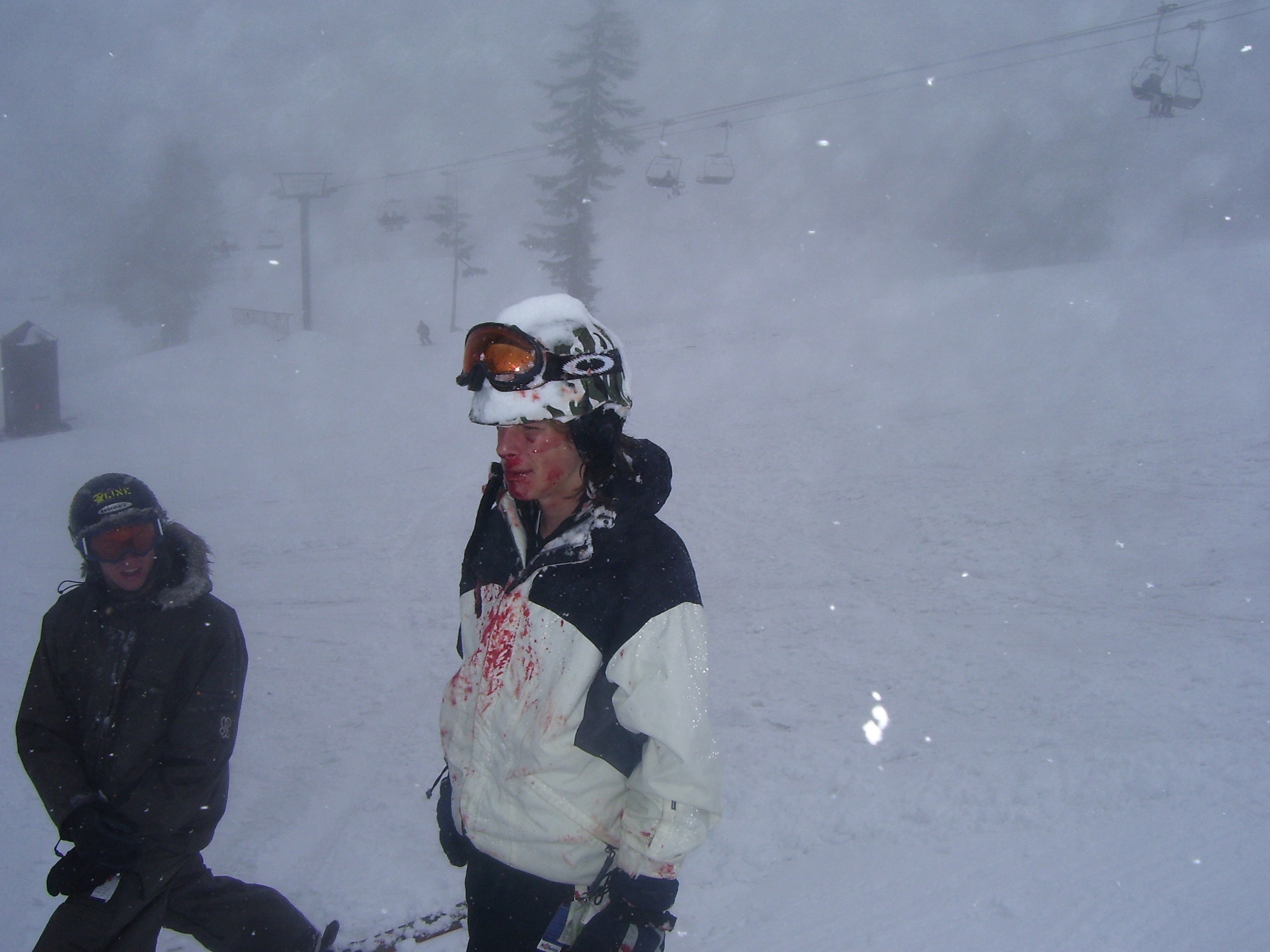 My face vs the ground