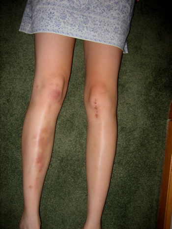 My legs- soo hot right now...