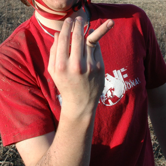 My nicely broken finger