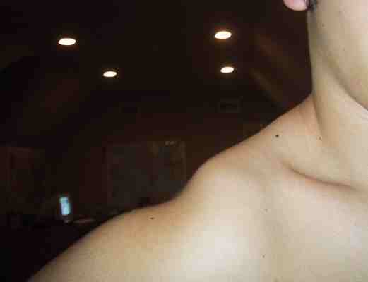 My Shoulda after SMS .....i aired 8 feet out of the qp, nailed the lip, and fell 25 feet onto it!  o