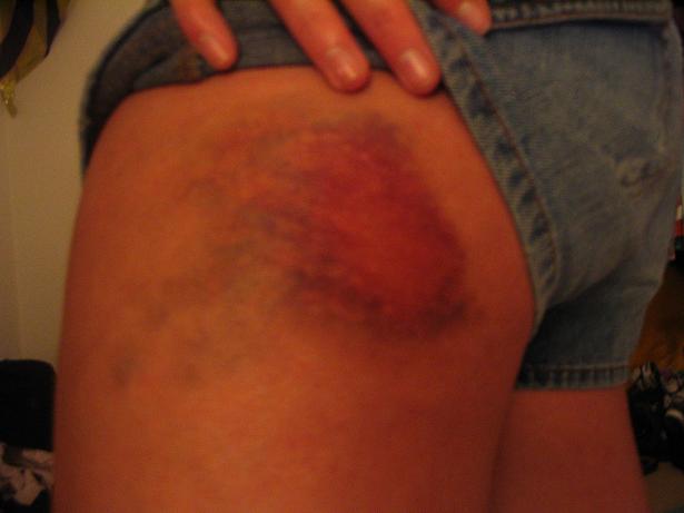 My sister's first attempt at a box