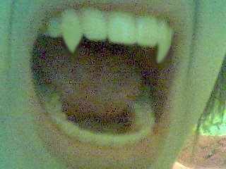 My teethSssS     FANGSssS..is this even in the right section?