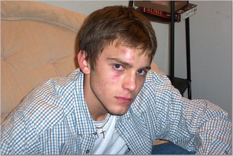 never get in a fight with your trampoline.. tried to land a double front 9... got half way through t