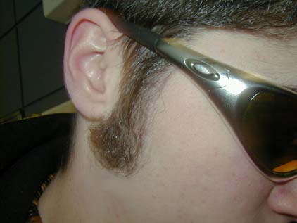 One of my sideburn.  Yeah it's sexy.