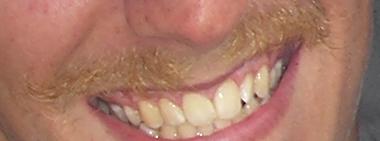 Pimipin moustache, look and learn kiddies.