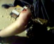 Rail messed up my knee, pic right after it happened