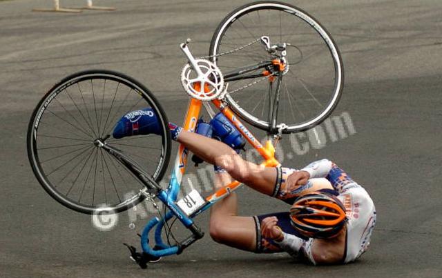 Road rash, fackin' OUCH!