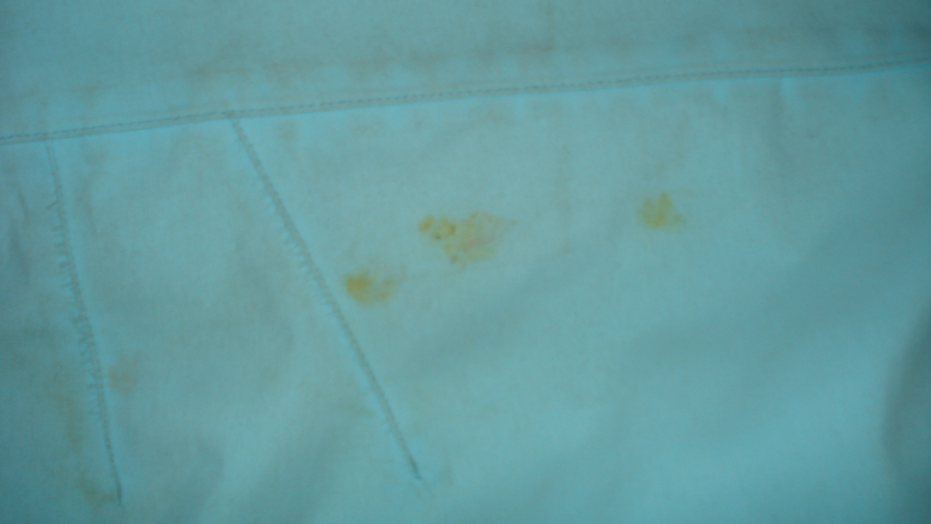 Saga stain on sleave.