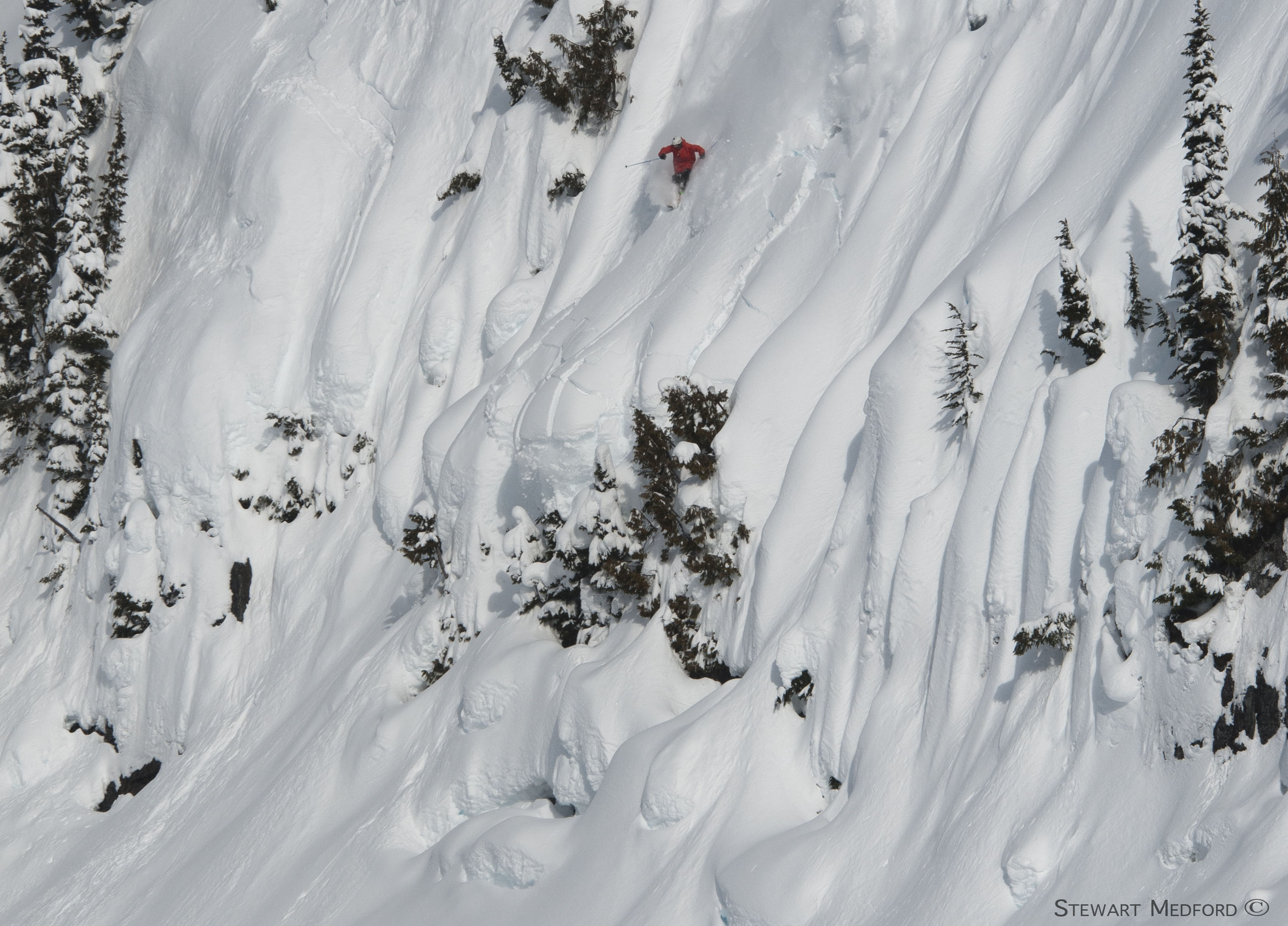 shreding mid fracture 