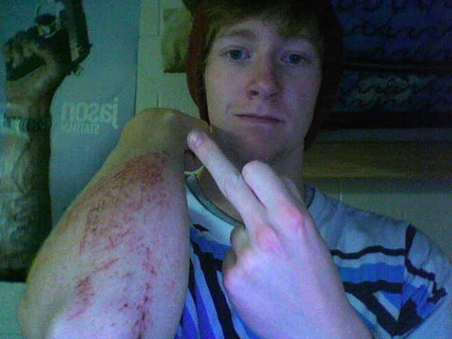 Snow Rash at Powder Mountain