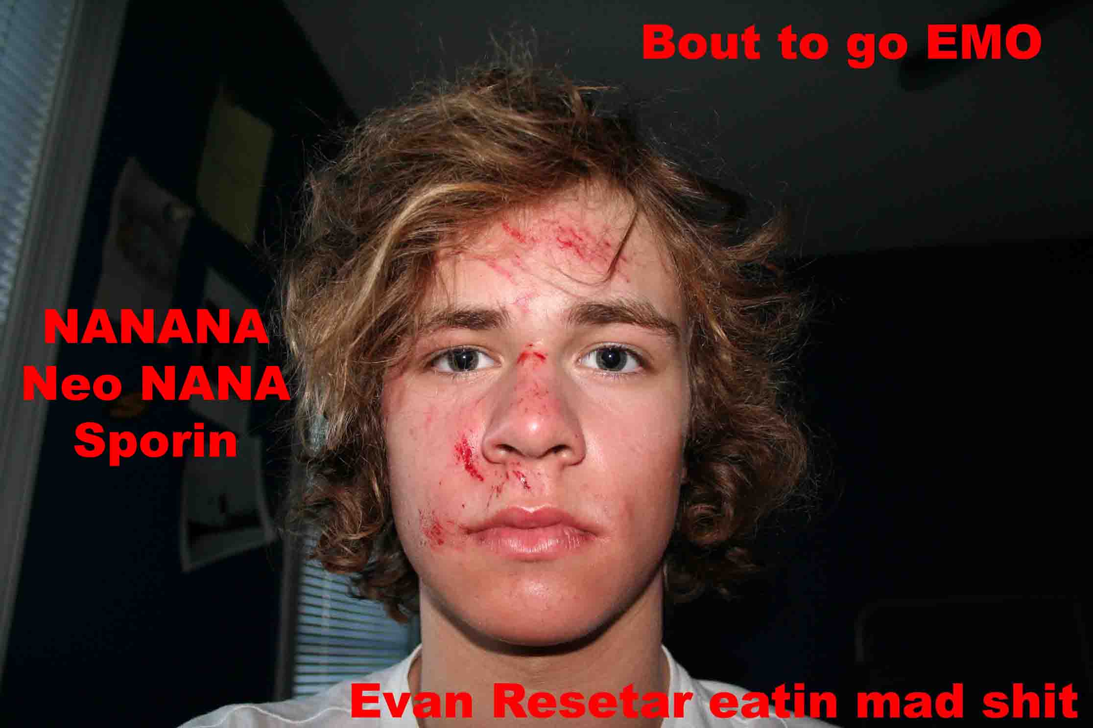 So i fell...on my face