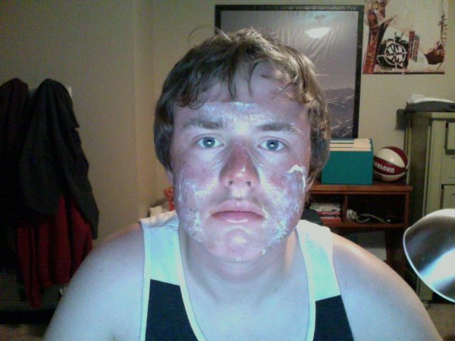 Spring Skiing Sunburn