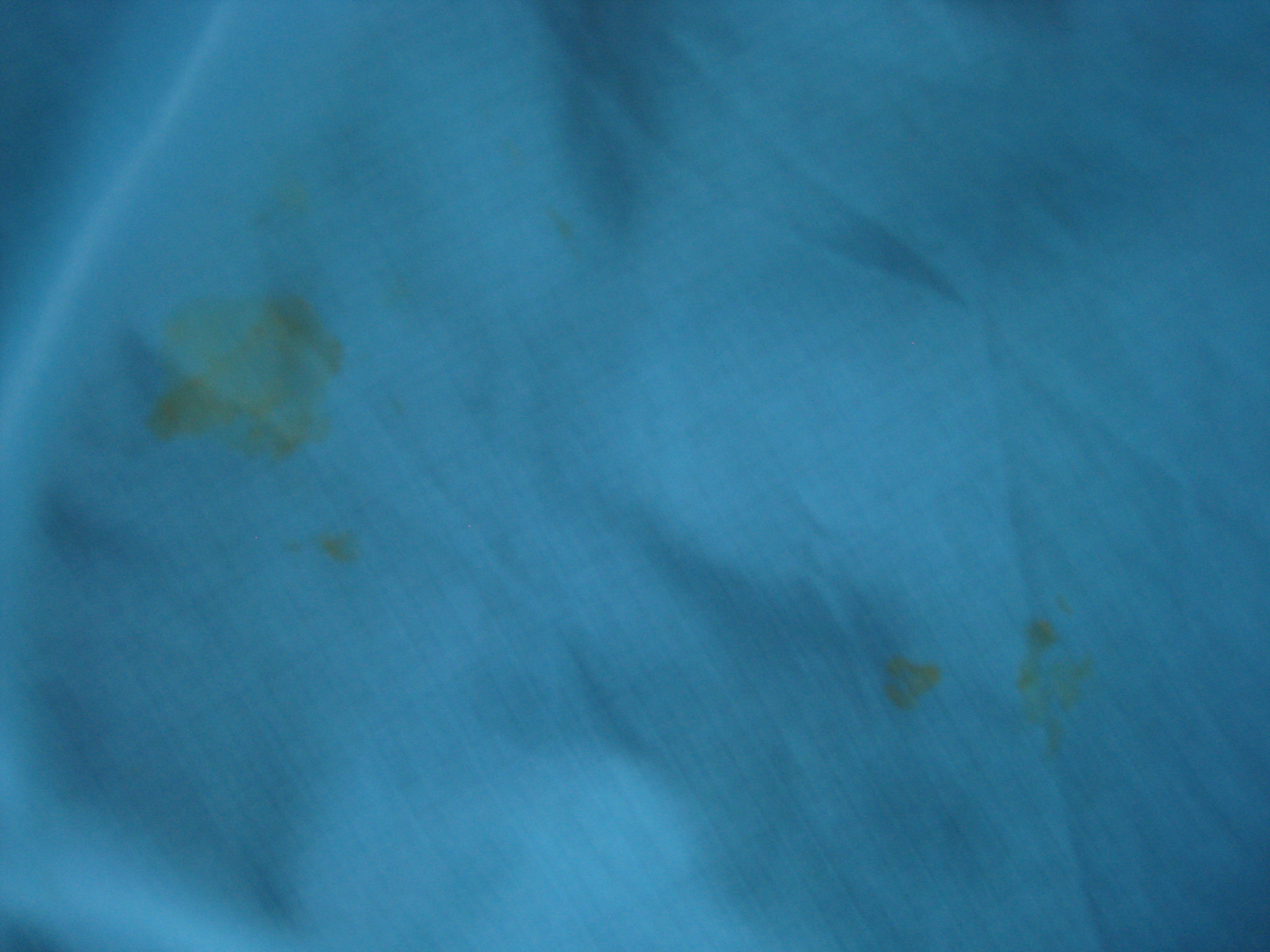 Stains on back of jacket