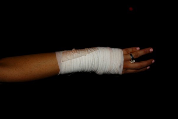 Stupid snowboarding injury