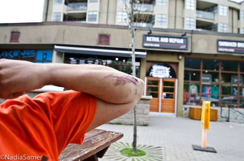 Summer is here, time to bleed!