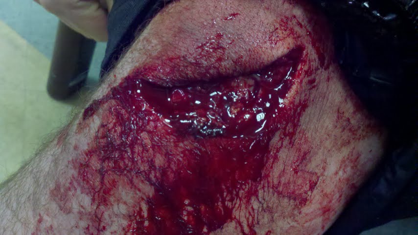 Switch up on suspect down rail equals...