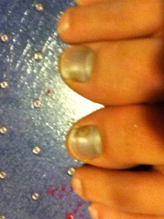 The Consequences of Not Wearing Full Tilts