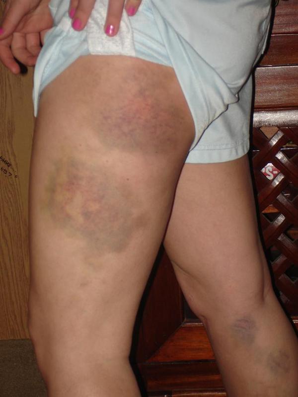 The downside to learning rails..no pain, no gain!