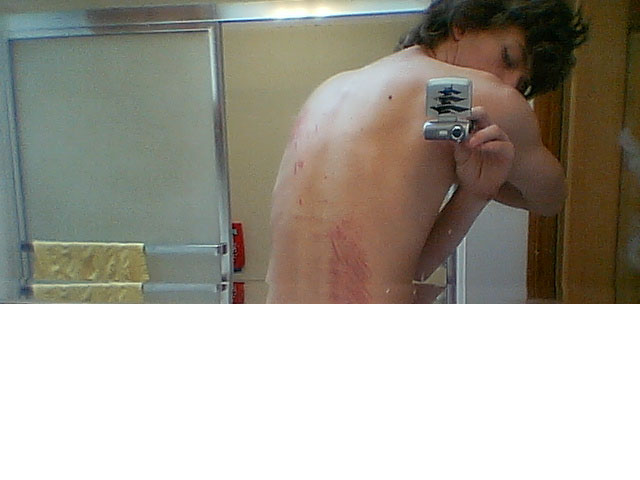 the other side of my back