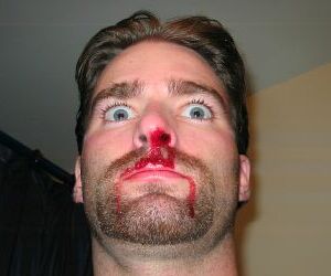 The Scariest Man in Skiing