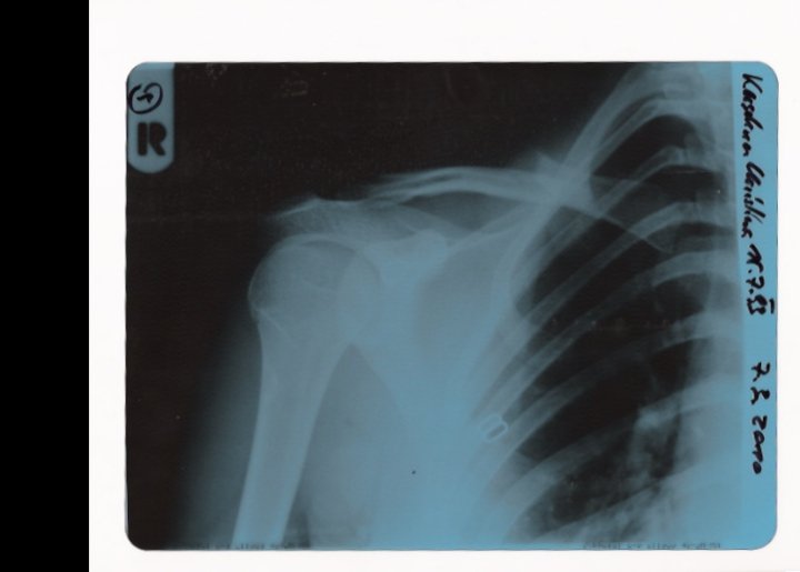 This is how my first freeski-season ended