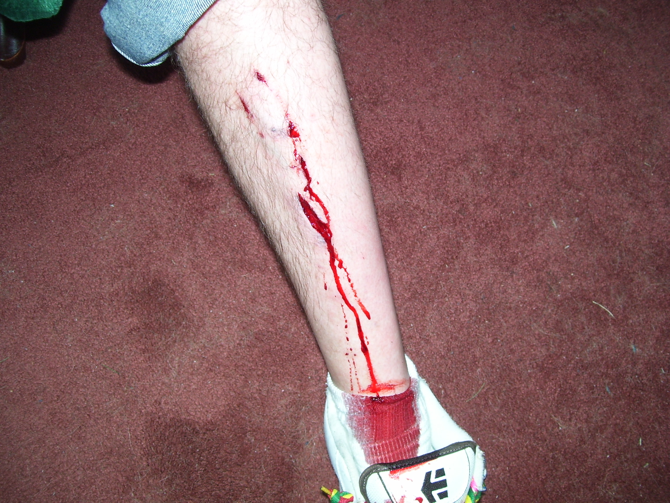 This is the really not  pretty pic