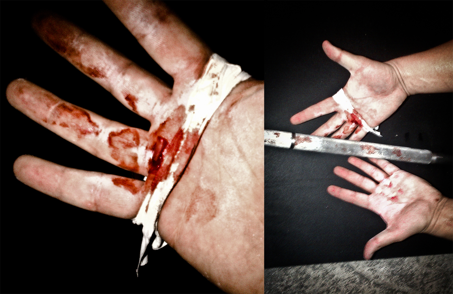 Torn hands at crossfit