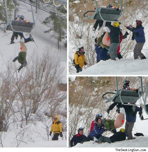 Vale - guess where he got frostbite